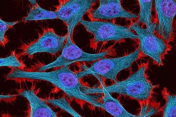 Multiphoton fluorescence image of HeLa cells